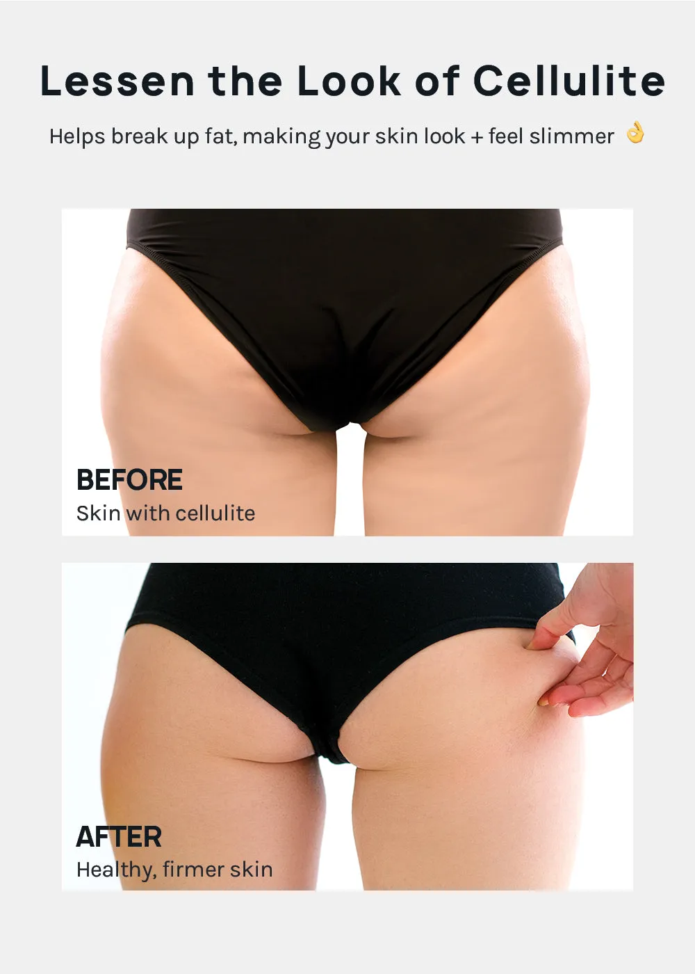 A  Cellulite Massage Roller